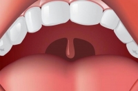 Опух язычок в горле: причины, что делать?
